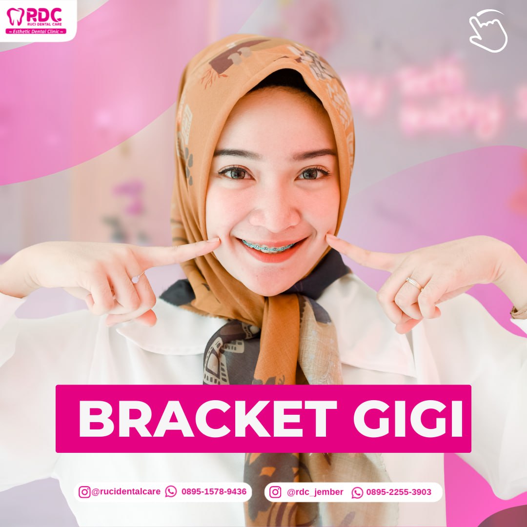 Behel Gigi / Ortodonti